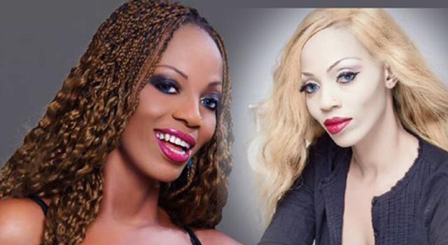 cameroun-depigmentation-:-les-produits-decapants-en-perte-d’eclat